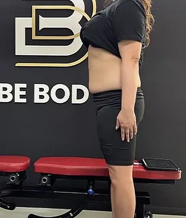 44歳女性 3ヶ月後