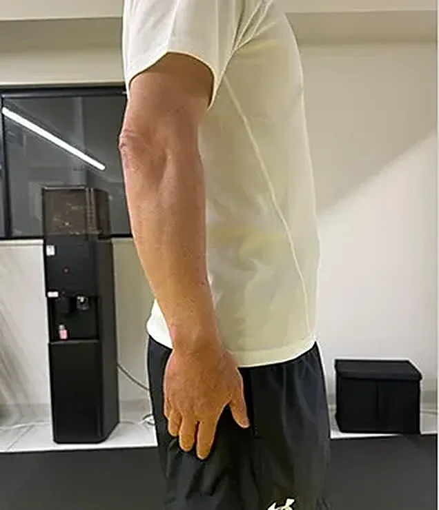 60歳男性 2ヶ月後